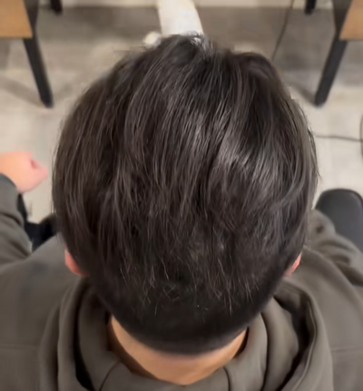 After
